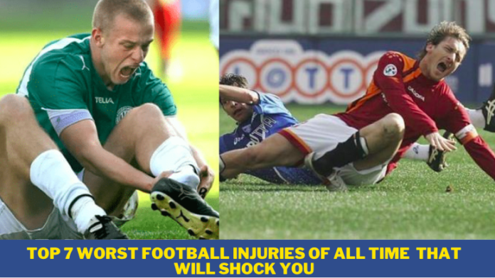 The Top 7 Worst Football Injuries Of All Time That Will Shock You